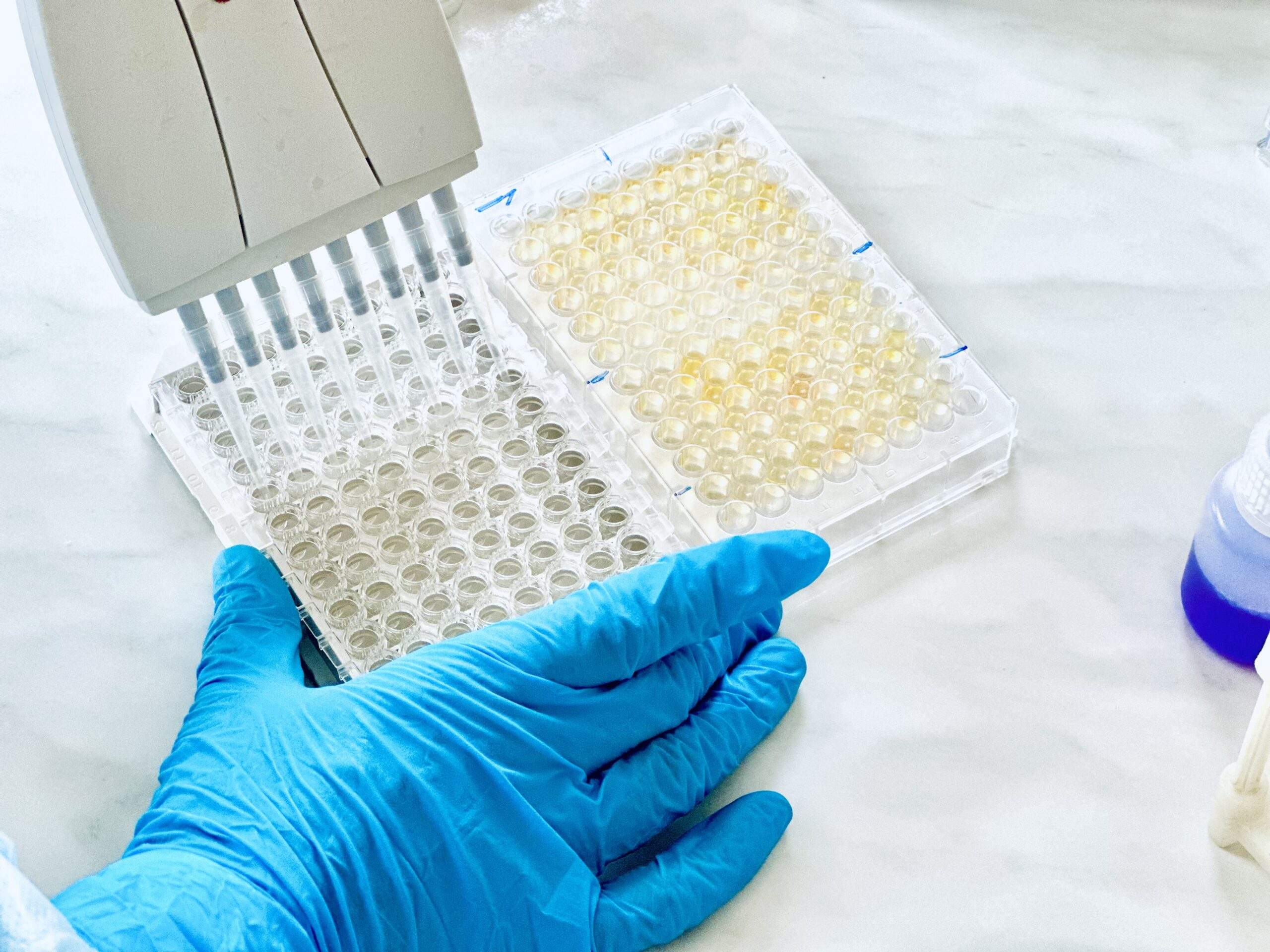 ELISA 96-well microplate testing